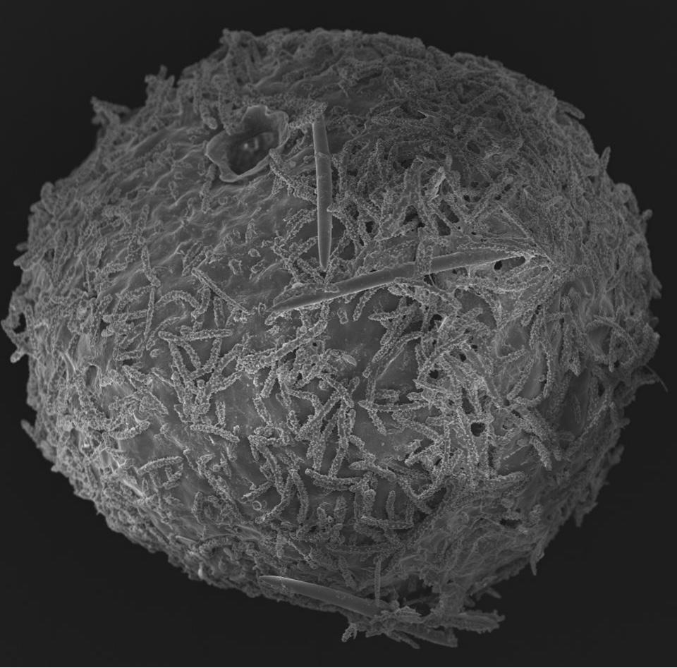 Picture of a freshwater sponge gemmule taken by Nicole de Voogd